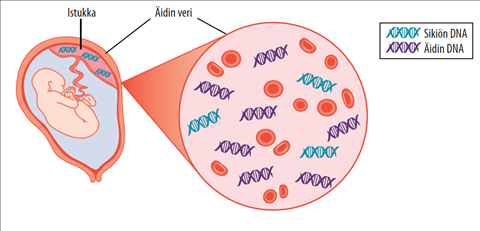 Sikiön diagnoosi äidin verestä - kajoamaton kromosomipoikkeavuuksien  seulonta