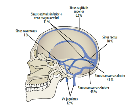 Левый синус. Сагиттальный синус. Sinus sagittalis Superior. Sinus sagittalis inferior. Sinus petrosus inferior.